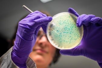 Akkermansia muciniphila gut health and microbiome research